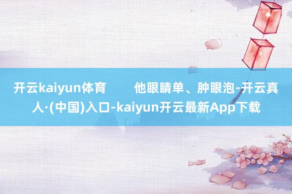 开云kaiyun体育        他眼睛单、肿眼泡-开云真人·(中国)入口-kaiyun开云最新App下载